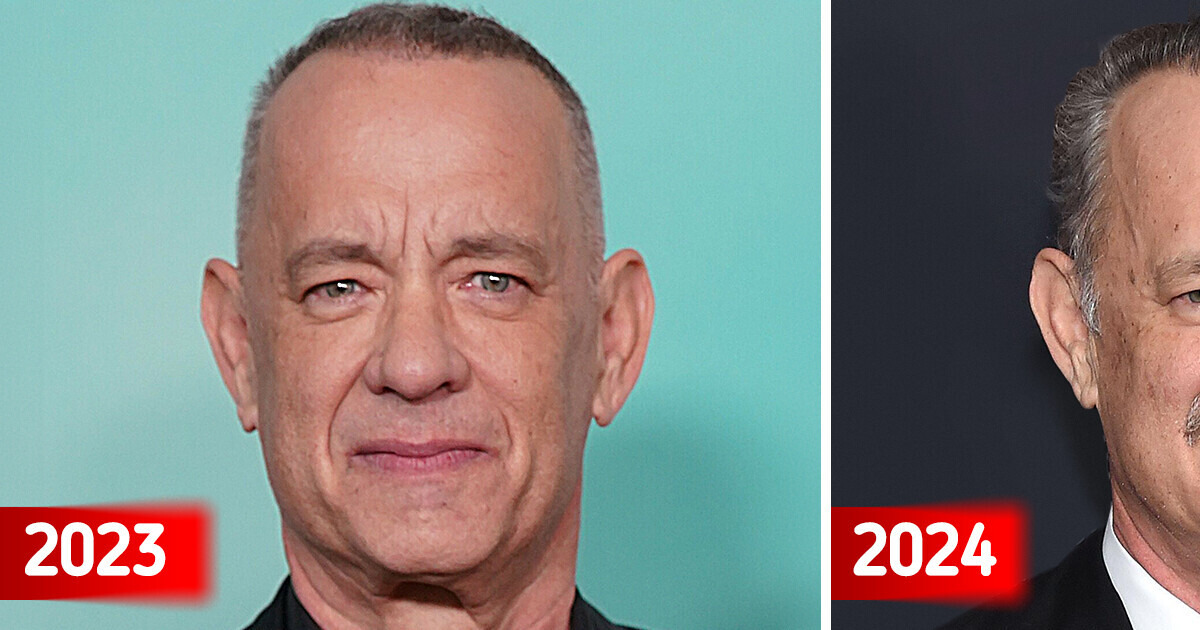 ”Is He Ok?” Tom Hanks Shocks Fans in New Look — Fans Are Worried / Bright Side – Dog Stories